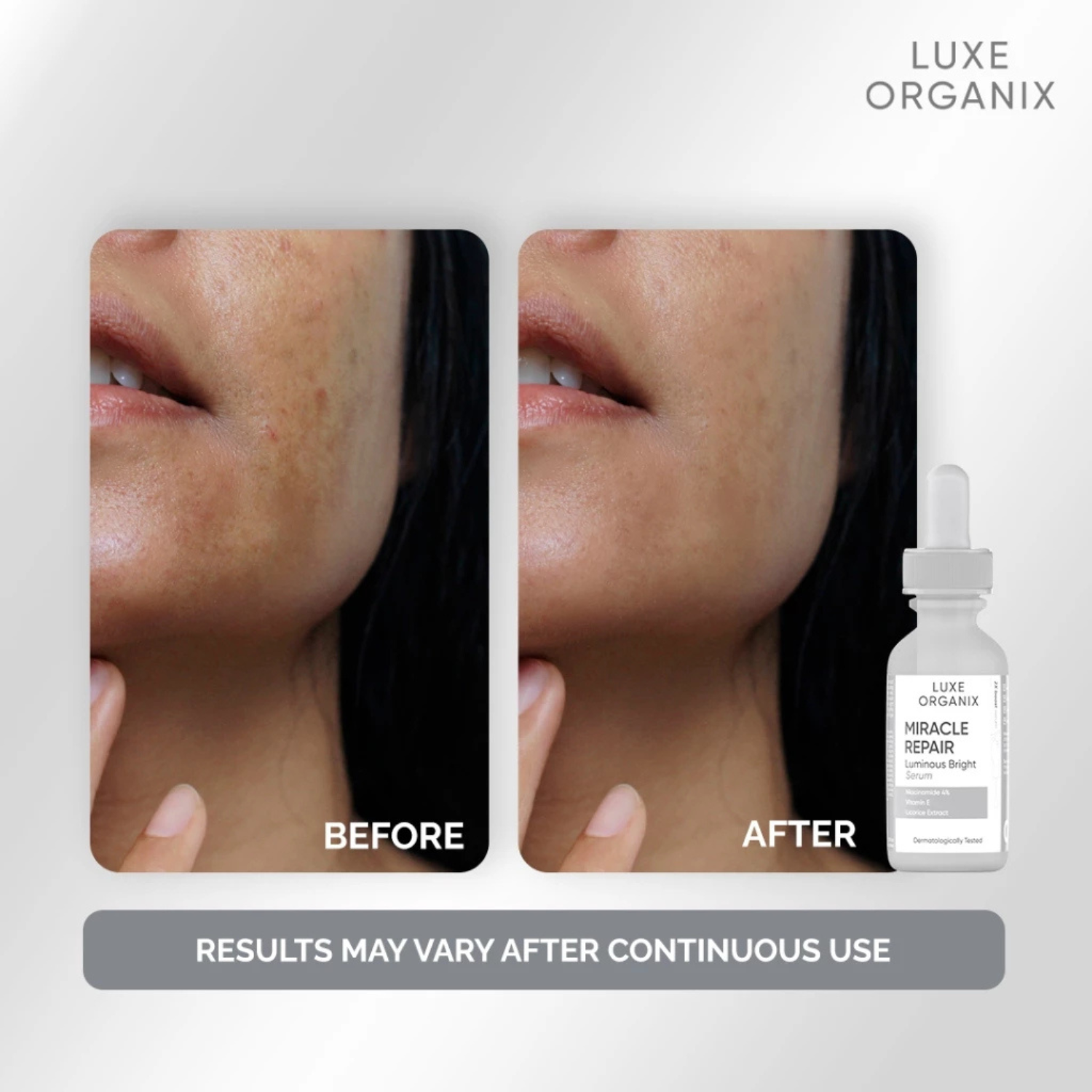 Miracle Repair Niacinamide 4% Serum 30mL