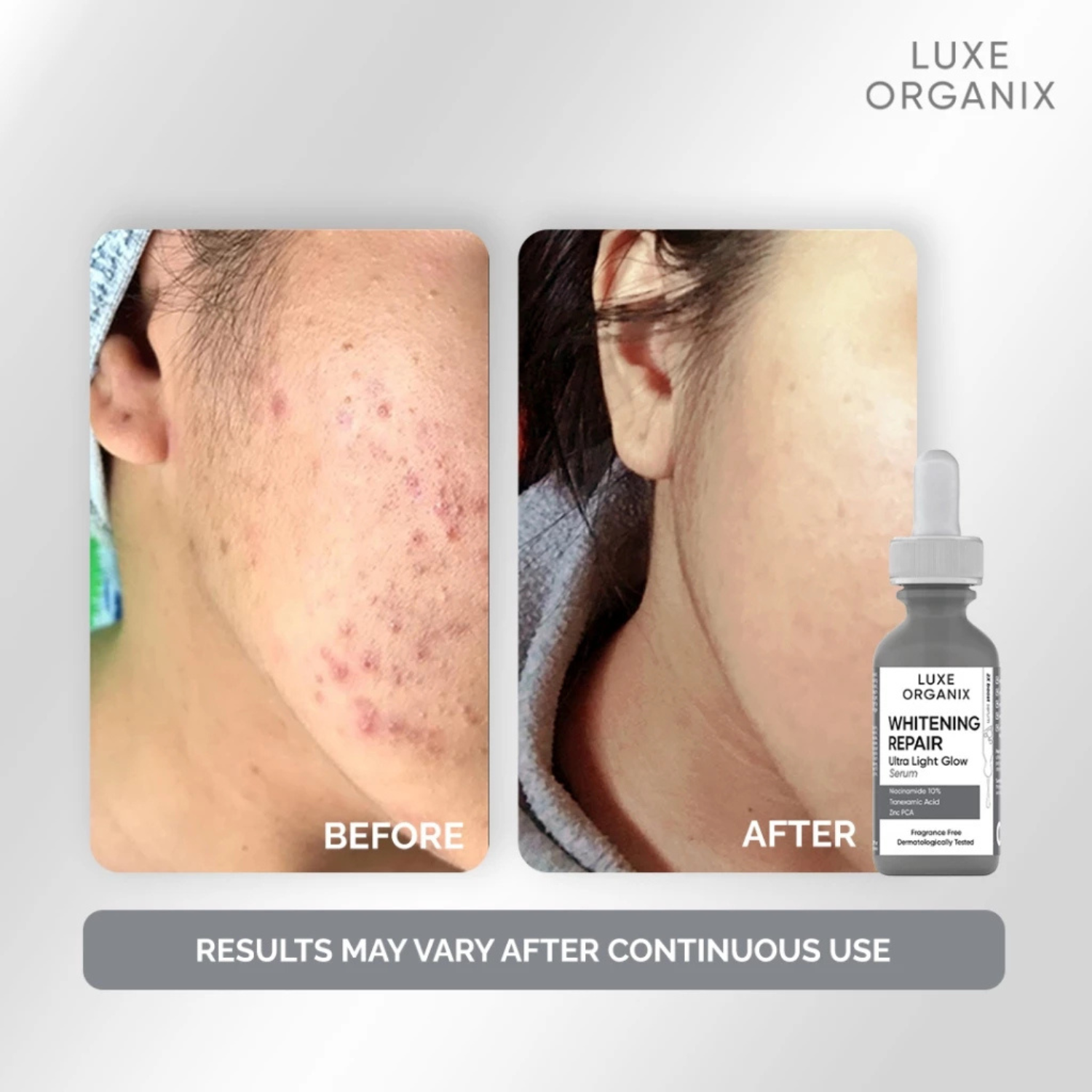 Whitening Repair Serum Niacinamide 10% 30ml