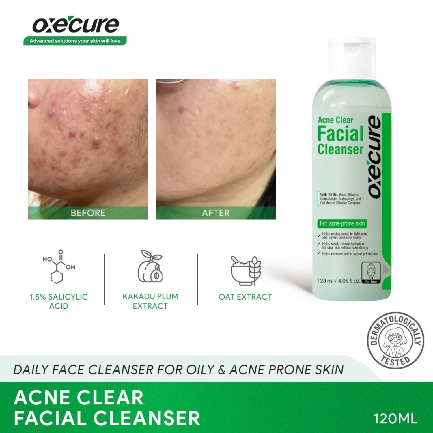 Acne Clear Facial Cleanser